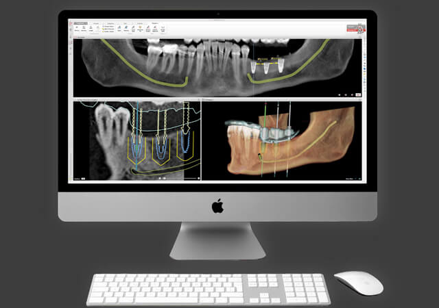 3D techonologie