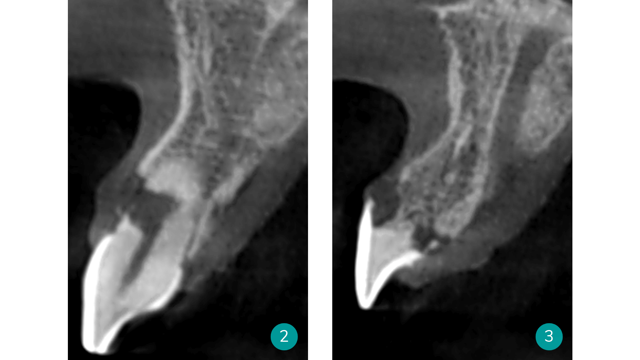 ct-scan